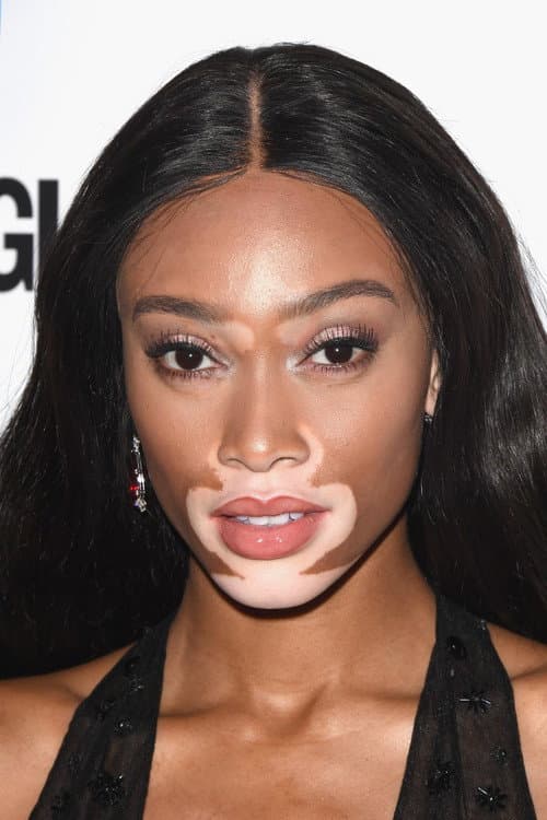 Winnie Harlow_avatar