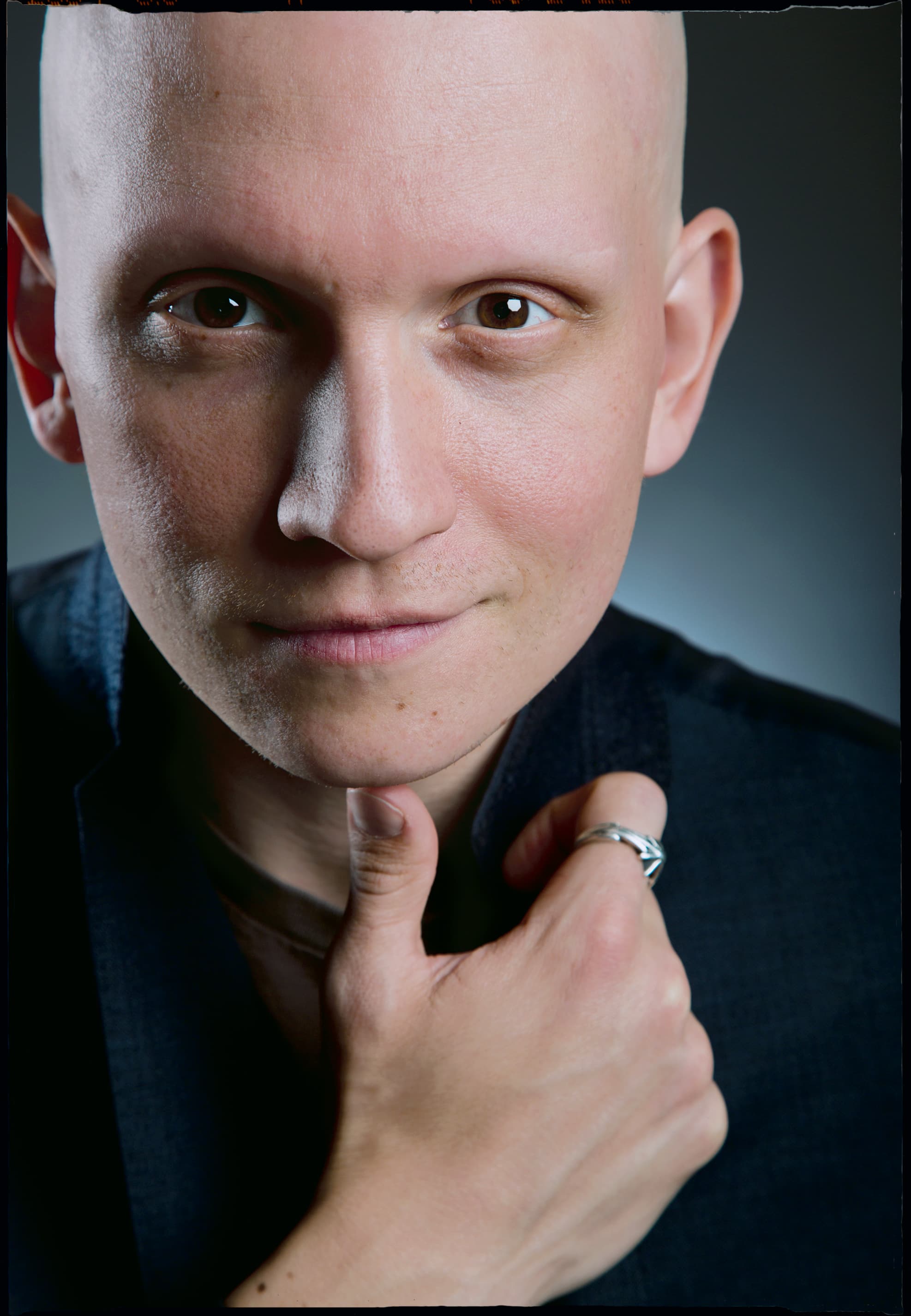 Anthony Carrigan_avatar